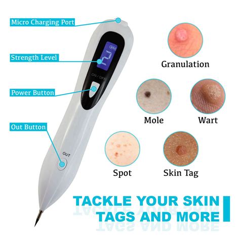 skin tag removal machine